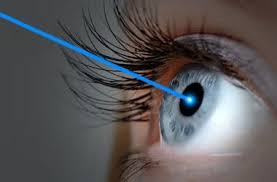 The LASIK procedure - How LASIK eye surgery works