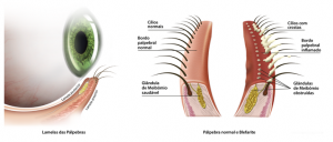 HORDÉOLO / TERÇOL – Dr. Milton Agrizzi David